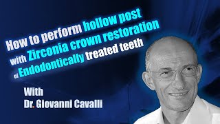 How to perform hollow post with Zirconia crown restoration of Endodontically treated teeth [upl. by Samuella346]