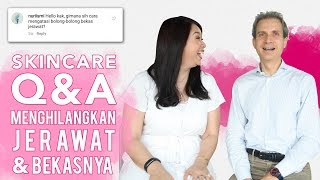 Produk untuk Jerawat dan Bekas Jerawat  Instagram QampA  Skincare 101 [upl. by Tamberg]