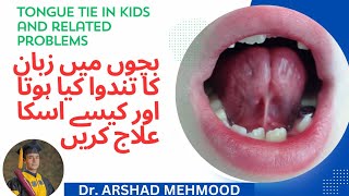 Tongue tie diagnosis and treatment  Zuban ka Tandwa ilamat aur ilaj Speech delay  urdu hindi tips [upl. by Orfurd]