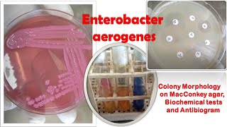 Enterobacter aerogenes Colony Morphology on MacConkey agar Biochemical tests and Antibiogram Demo [upl. by Seely]