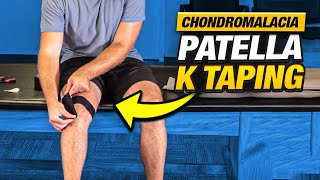 Relieve Knee Pain FAST Chondromalacia Patella K Taping [upl. by Lasala]