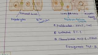 Liver Cirrhosis [upl. by Llennehc373]