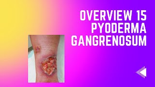 Overview 15  Pyoderma Gangrenosum [upl. by Alleuol]