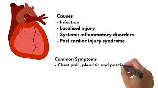 ECG changes Pericarditis [upl. by Ained]