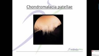 Patellofemoral Terminolgy3 Minute top tips [upl. by Dnalra139]