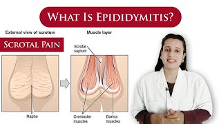 What is Epididymitis  causes symptoms treatment  scrotal pain  By Dr N Joshi [upl. by Kucik]