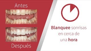 Conozca el blanqueamiento dental en consultorio Opalescence Boost [upl. by Eidnalem429]