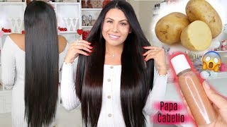 Papa Para el Crecimiento Extremo del cabello en 2 Semanas 🥔fashionbycarol [upl. by Amsirac]