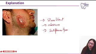 NEET MDS 2023 Pathology  cervicofacial actinomycosis [upl. by Norse32]