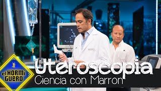 ¡Ureteroscopia en directo Marron nos presenta una revolución para la medicina  El Hormiguero [upl. by Kippar35]