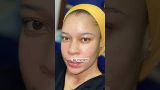 How to get rid of hyperpigmentation in months skincareroutine skincaretips hyperpigmentation [upl. by Mosera]