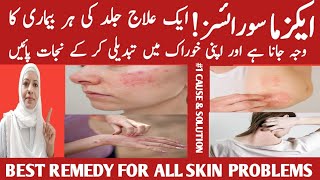 One Treatment For All Skin Problems The Most Common Deficiency In All Skin Diseases Listen Your Bo [upl. by Ahsiatal]