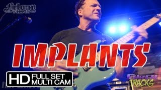 IMPLANTS  Constellation Room full set multi cam [upl. by Llebasi180]