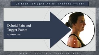 Deltoid Pain and Trigger Points [upl. by Maia]