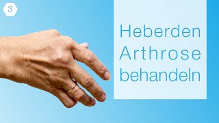 3 Heberden Arthrose Behandeln Erfahrungsbericht 2018 [upl. by Attenreb770]