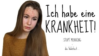 Ich habe eine KRANKHEIT  Typisch Kassii [upl. by Mossolb787]