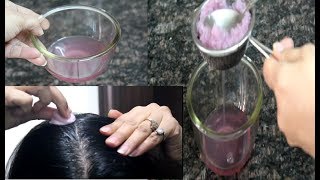 How To Use Onion Juice For Hair RegrowthDandruff Hair fall Control Premature Greying Of Hair [upl. by Ness638]