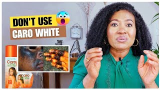 Caro White Bleaching Cream EXPOSEDSIDE EFFECTS Of Skin Bleaching [upl. by Retnyw]