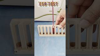 Esr westergren method  ESR test means  What does ESR lab test showlaboratory test bloodtest [upl. by Demitria]