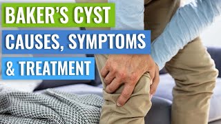 Baker’s Cyst Causes Symptoms Treatment Conservative vs Surgery [upl. by Terrye]