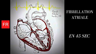 Arythmies animation cardiaque et ECG  Fibrillation Atriale Shorts [upl. by Accisej]