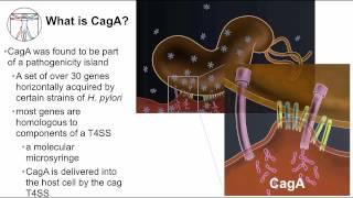 Gastritis H pylori cancer pathogenesis [upl. by Blackmun]