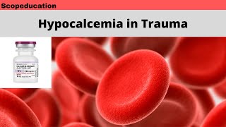 Hypocalcemia in Trauma [upl. by Bettina70]