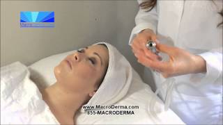 Macrodermacom  Diamond Tip Microdermabrasion Simulation [upl. by Weir425]