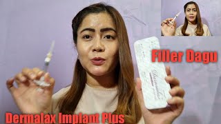 Filler Dagu  Implant Plus  Dermalax fillersinjection filler [upl. by Yelrebma]