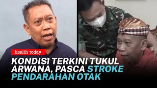 Penjelasan Dokter Soal Stroke Pendarahan Otak yang di Alami Tukul Arwana  Health Today 31 [upl. by Culbertson]