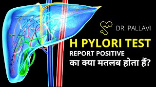 H Pylori Positive Report Meaning and Symptoms  Helicobacter Pylori Test Report Explained [upl. by Eltsyrk554]