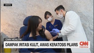 Dampak Iritasi Kulit Awas Keratosis Pilaris [upl. by Lanae145]