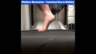 The Windlass mechanism in the foot adds stability and promotes painfree walking when the foot is su [upl. by Lrub152]