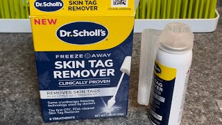 Dr Scholl’s Skin Tag Remover  Application and After 7 day Results [upl. by Klina]