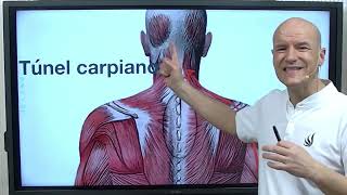 Causas diagnóstico y tratamiento integrativo del Túnel Carpiano [upl. by Kenwrick]