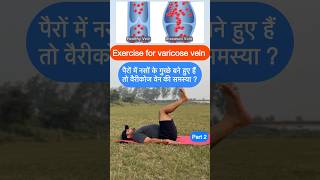 Treatment for varicose vein at home yoga fitness ytshorts [upl. by Ahsimed]