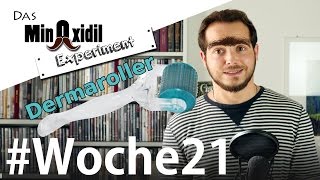 Was ist ein Dermaroller  Das Minoxidil Experiment Woche21 [upl. by Rodolfo]