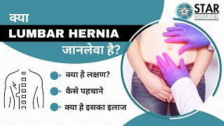 Lumbar Hernia in Hindi  Causes Symptoms Tests Exercises amp Treatment  Laparoscopic Management [upl. by Aneev340]