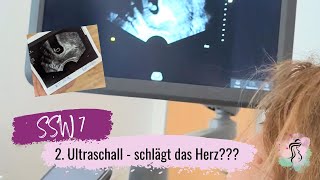 SSW 7  2Ultraschall  Schlägt das Herz 🥹  Mädchen oder Junge Ramzi Methode [upl. by Branch919]