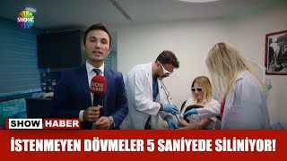 İstenmeyen dövmeler 5 saniyede siliniyor [upl. by Notserk752]