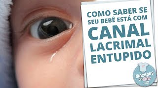 CANAL LACRIMAL ENTUPIDO E COMO TRATAR A OBSTRUÇÃO  MACETES DE MÃE [upl. by Faus]