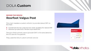 Rearfoot Valgus Post DOLA Orthotics Orthotips [upl. by Abercromby]