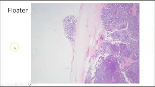 Artifacts in Histopathology and Cytopathology [upl. by Amliv983]