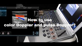 How to use color Doppler and pulse Doppler on ultrasound？ [upl. by Pavkovic]