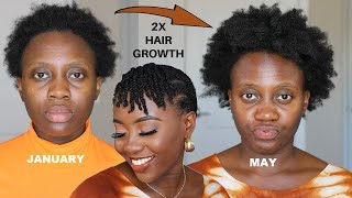 The Only Protective Style That Doubled My 4C Hair Growth  Twists [upl. by Zilevi415]