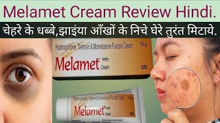 Melamet Cream ke Fayde Melamet Cream ki Jankari Melamet Cream Uses in Hindi [upl. by Amice]