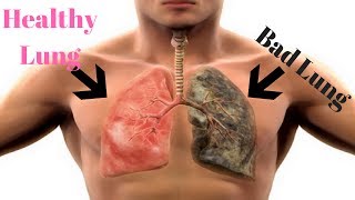 Cleanse and Rejuvenate Smokers Lungs  How to Detox Smokers Lungs Fast [upl. by Delaryd]