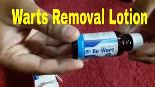 Wart Removal Lotion [upl. by Alacim]