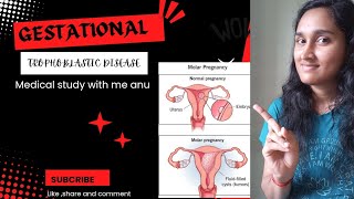 Gestational trophoblastic disease part1 molar pregnancy pathology molarpregnancy [upl. by Ahterod]