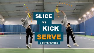 Slice vs Kick Serve  3 Key Differences TENFITMEN  Episode 181 [upl. by Winslow324]